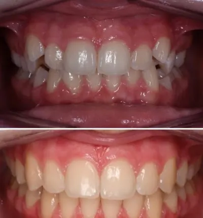 Kopryk Filip, lek. implantolog. Gabinet stomatologiczny, implanty